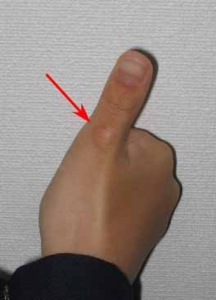 癖と歯列不正 5 指しゃぶり そえじま矯正歯科