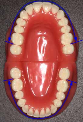 上 の 歯 と 下 の 歯 が くっつく